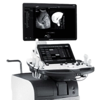 Ультразвуковой сканер Samsung Medison